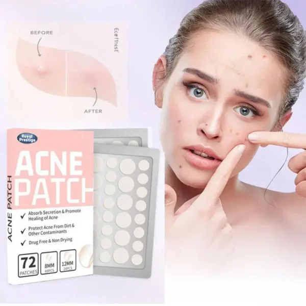 Acne huid genezen