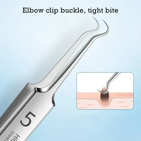 Duitse Ultra-Fijne Nr 5 Cel puistjes BlackheadAcne Clip Home huidverzorging routine pincet schoonheid gezicht gezondheidssalon speciale mee-eters verwijderaar acne naald tool